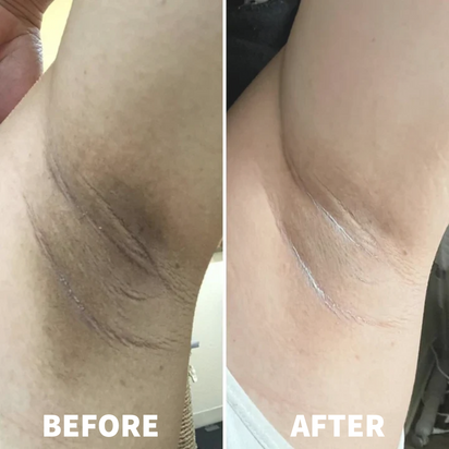 Dr. Melaxin Peel Shot™