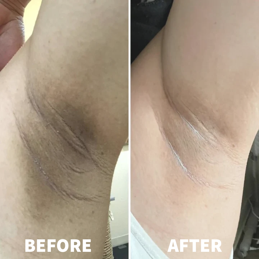 Dr. Melaxin Peel Shot™