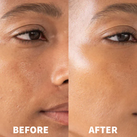 Dr. Melaxin Peel Shot™